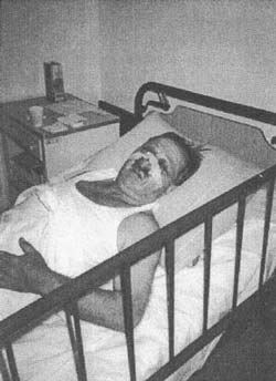 Muhamed Elezovic u mostarskoj bolnici